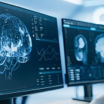 Ученые связали загрязнение воздуха с повышенным риском развития БАС